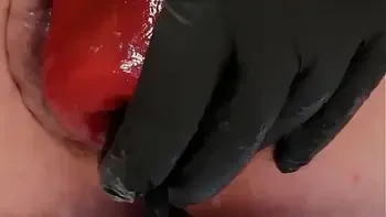 Contender For Biggest Prolapse (Male Warning!)