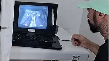 Gynecologist Performs Ultrasound On The Cuckolds Wife